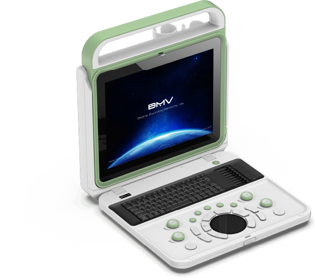 BPU50C EXP Portable Color Doppler Ultrasound(Color Doppler System Improve Patient Care Quality)