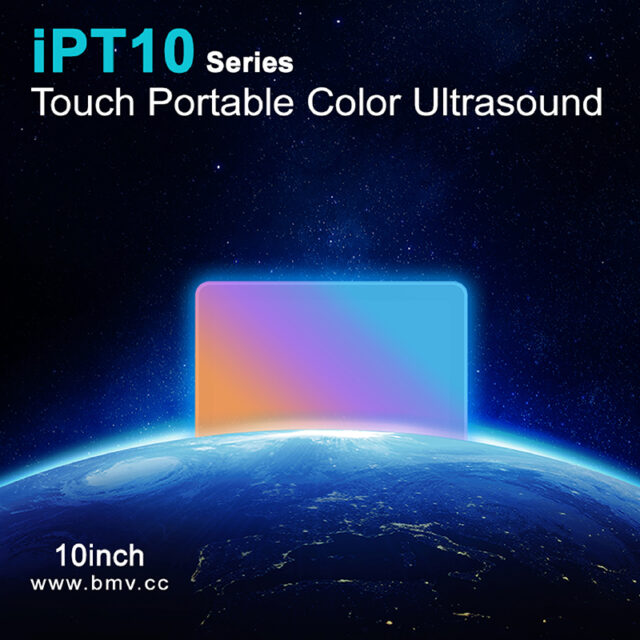 BladderSense iPT10 Bladder Scanners