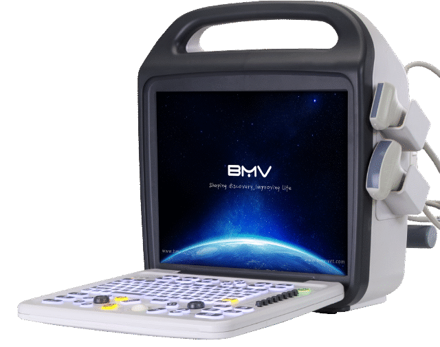 BCU30 64 Channels Portable Color Doppler Ultrasound System